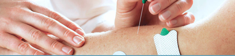 elettromiografia - Biomedica Tortonese